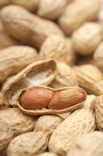 Learn to manage peanut allergy with these helpful tips. 
