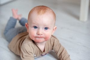 Staph infection in young children with severe eczema boosts their chances of developing food allergies.
