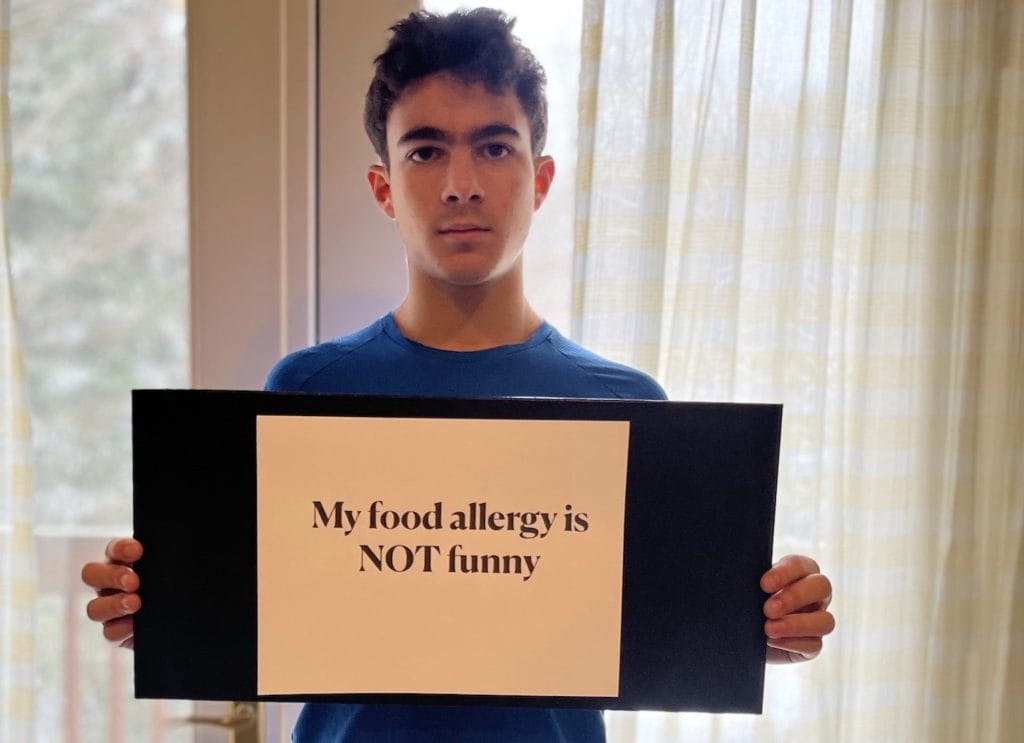 Teen with food allergy sign